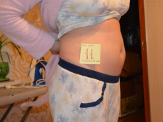 Обследование и скрининг на 11 неделе беременности