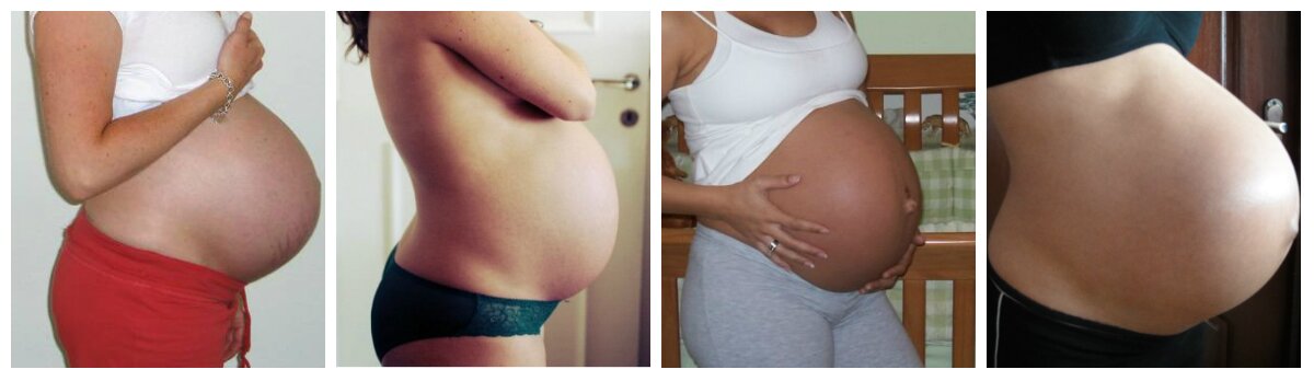 40 неделя беременности отеки не шевелится ребенок thumbnail