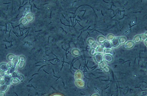Колония бактерий под микроскопом
