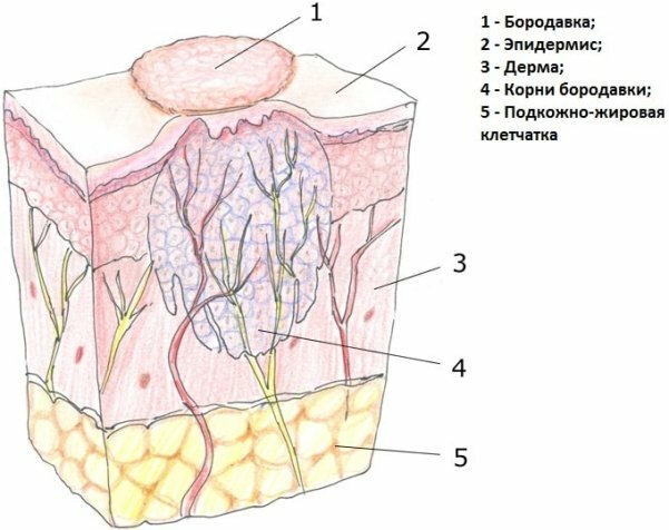 Структура пораженной ткани