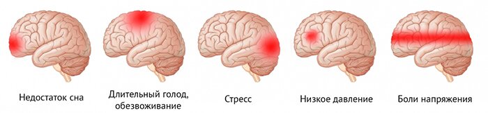 Профилактика головных болей